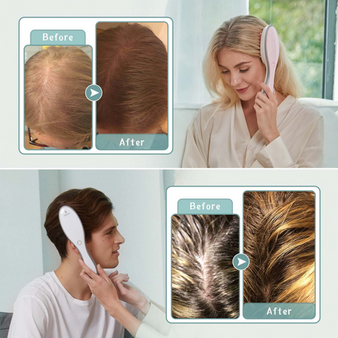 I-HELMET Laser Hair Growth Comb